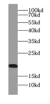 ARF6 Specific Rabbit Polyclonal Antibody