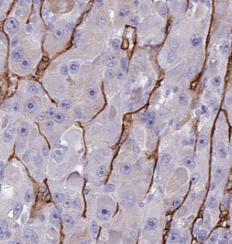 ARF6 Specific Rabbit Polyclonal Antibody