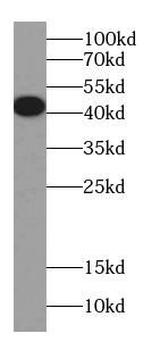 ARR3 Rabbit Polyclonal Antibody
