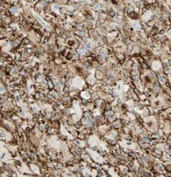 ARR3 Rabbit Polyclonal Antibody