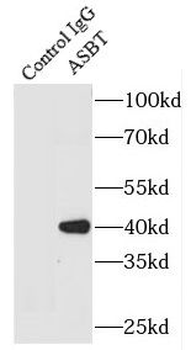 SLC10A2 Rabbit Polyclonal Antibody