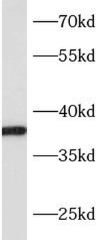 SLC10A2 Rabbit Polyclonal Antibody