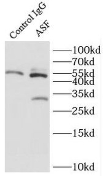 SRSF1 Rabbit Polyclonal Antibody
