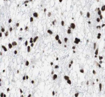 SRSF1 Rabbit Polyclonal Antibody