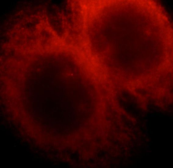 ATXN2 Rabbit Polyclonal Antibody