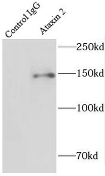 ATXN2 Rabbit Polyclonal Antibody