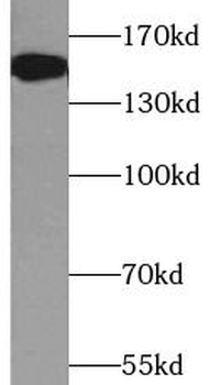 ATXN2 Rabbit Polyclonal Antibody