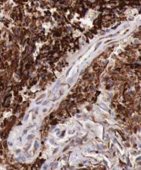 ATXN2 Rabbit Polyclonal Antibody