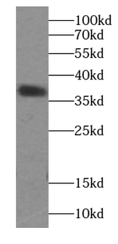 ATXN3 Rabbit Polyclonal Antibody