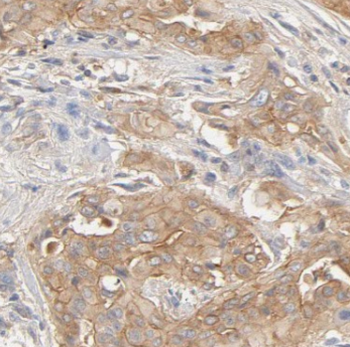 ATXN3 Rabbit Polyclonal Antibody