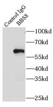 TTC8 Rabbit Polyclonal Antibody