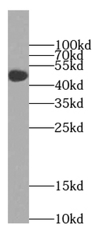 TTC8 Rabbit Polyclonal Antibody