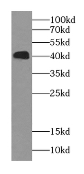 SH3GLB1 Rabbit Polyclonal Antibody