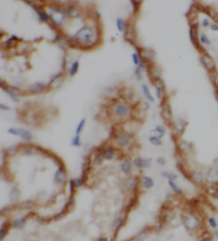 SH3GLB1 Rabbit Polyclonal Antibody