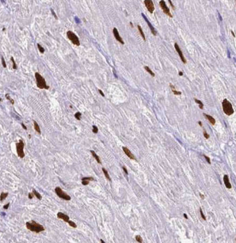 BRD8 Mouse Monoclonal Antibody