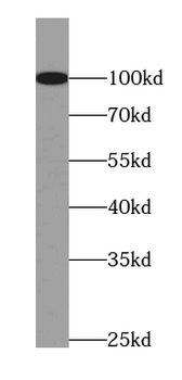 MCPH1 Rabbit Polyclonal Antibody