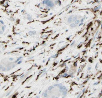 MCPH1 Rabbit Polyclonal Antibody