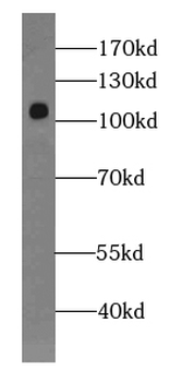MIS18A Rabbit Polyclonal Antibody