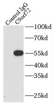 C9orf72 Mouse Monoclonal Antibody