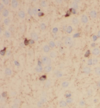 C9orf72 Mouse Monoclonal Antibody