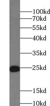 cTnI Rabbit Polyclonal Antibody