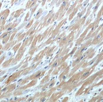 cTnI Rabbit Polyclonal Antibody