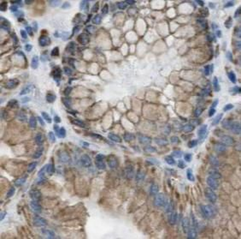 CCKAR specific Rabbit Polyclonal Antibody