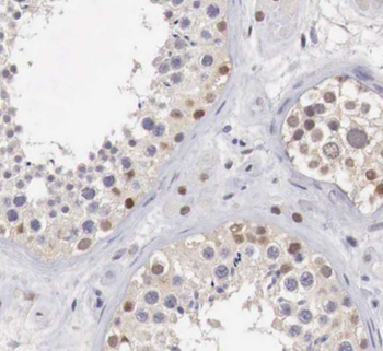 AGTPBP1 Rabbit Polyclonal Antibody