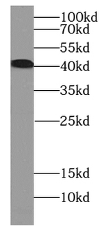 CCR2 specific Rabbit Polyclonal Antibody