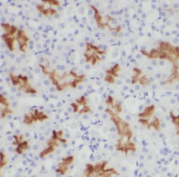 CCR2 specific Rabbit Polyclonal Antibody