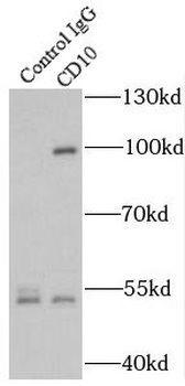 MME Rabbit Polyclonal Antibody