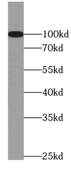 MME Rabbit Polyclonal Antibody