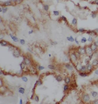 MME Rabbit Polyclonal Antibody