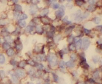 CD3G Rabbit Polyclonal Antibody