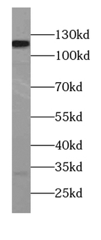 TSPYL2 Rabbit Polyclonal Antibody