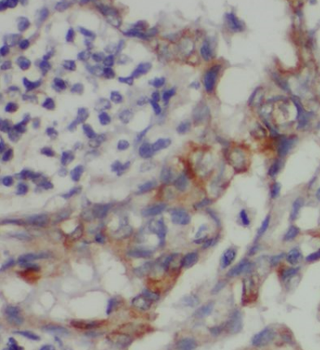 TSPYL2 Rabbit Polyclonal Antibody