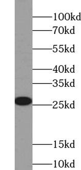 βHCG Mouse Monoclonal Antibody