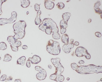 βHCG Mouse Monoclonal Antibody