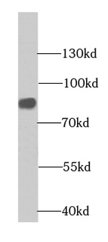CHPF C Terminal Rabbit Polyclonal Antibody