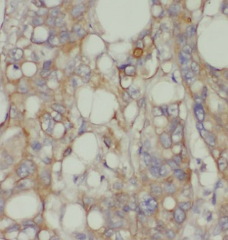 CHPF C Terminal Rabbit Polyclonal Antibody
