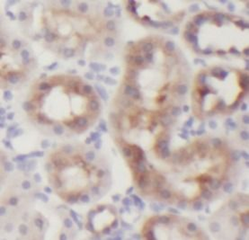 KIT Rabbit Polyclonal Antibody