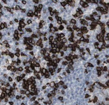 CLEC11A Mouse Monoclonal Antibody