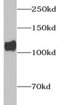 Collagen Type I Rabbit Polyclonal Antibody