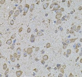 Collagen Type I Rabbit Polyclonal Antibody