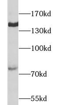Collagen Type II Rabbit Polyclonal Antibody