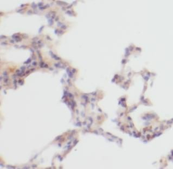 Collagen Type II Rabbit Polyclonal Antibody