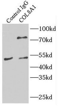 COL8A1 Rabbit Polyclonal Antibody