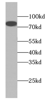 COL8A1 Rabbit Polyclonal Antibody