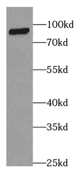 CFB Mouse Monoclonal Antibody