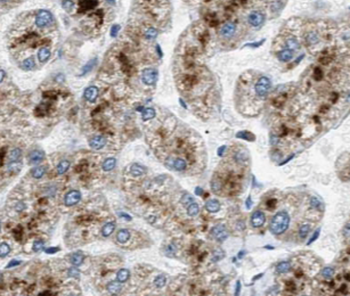 CFB Mouse Monoclonal Antibody